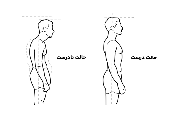 آیا کوهنوردی برای دیسک کمر ضرر دارد